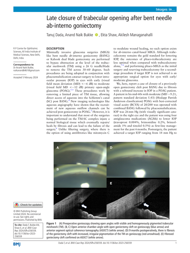 PDF extract preview