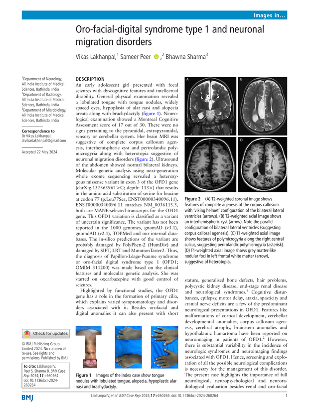 PDF extract preview