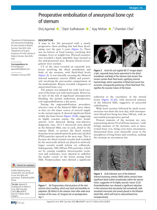 PDF extract preview