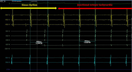 Figure 5